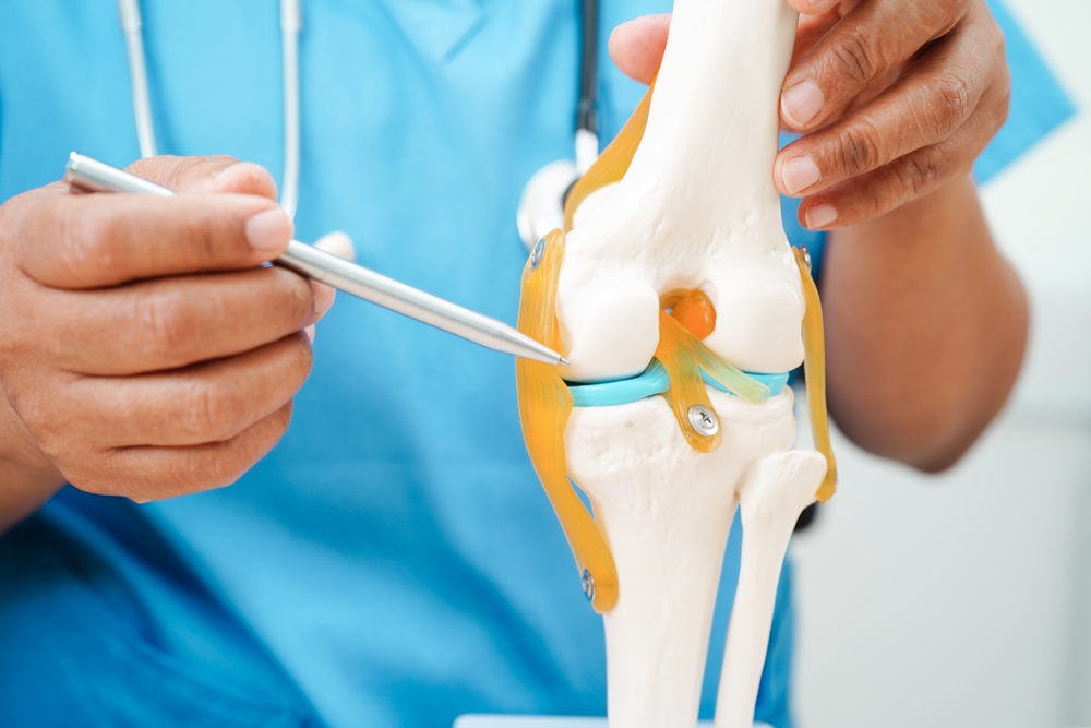 Knee,Osteoarthritis,,Doctor,Showing,Model,Knee,Joint,Orthopedic.