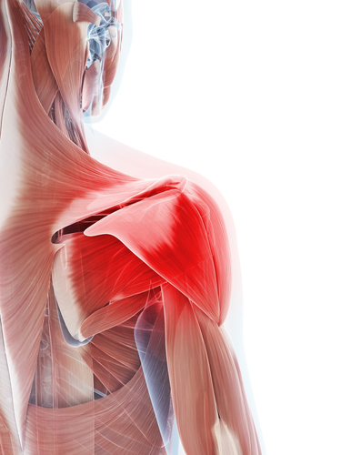 3d,Rendered,Illustration,Of,A,Painful,Shoulder